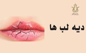 دیه لب در قانون مجازات اسلامی