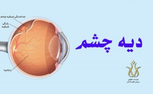 دیه چشم و بینایی در قانون مجازات اسلامی