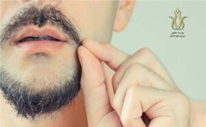 دیه کندن ریش مرد در قانون مجازات اسلامی